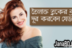 তৈলাক্ত ত্বকের ব্রণ দূর করার উপায়